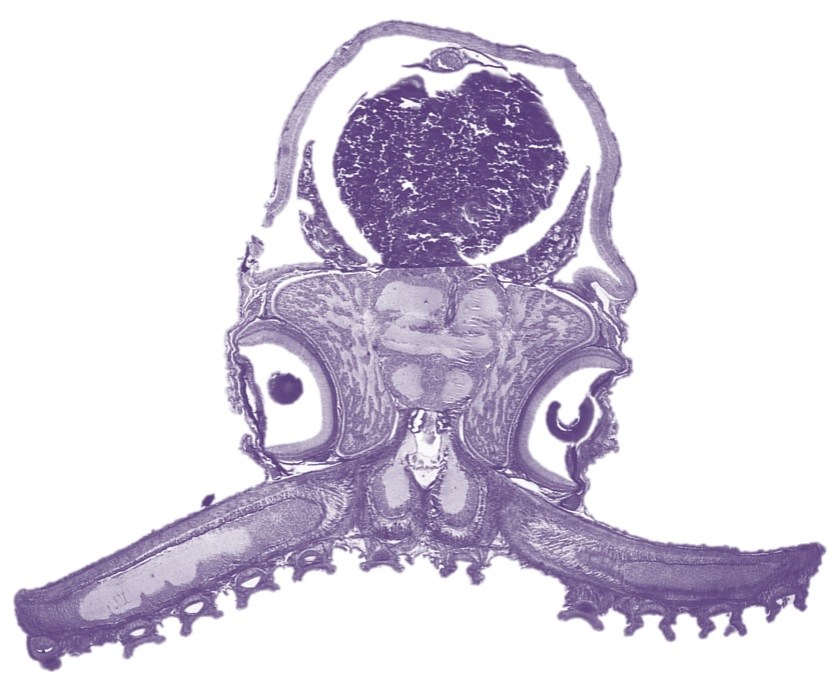 Paraoctopus
